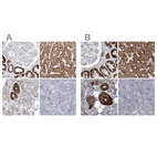 Immunohistochemical staining of human kidney, liver, salivary gland and tonsil using Anti-PCCB antibody HPA036940 (A) shows similar protein distribution across tissues to independent antibody HPA036939 (B).