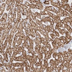 Immunohistochemical staining of human liver shows strong granular cytoplasmic positivity in hepatocytes.