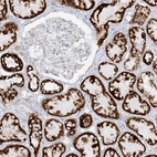 Immunohistochemical staining of human kidney shows strong granular cytoplasmic positivity in cells in tubules.
