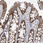 Immunohistochemical staining of human rectum shows strong granular cytoplasmic positivity in glandular cells.