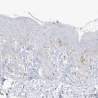 Immunohistochemical staining of human skin shows only weak cytoplasmic positivity in a subset of epidermal cells.
