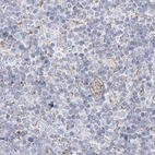 Immunohistochemical staining of human tonsil using Anti-PCCB antibody HPA036940.
