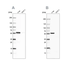 Western blot analysis using Anti-PCCB antibody HPA036940 (A) shows similar pattern to independent antibody HPA036939 (B).