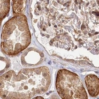Immunohistochemical staining of human kidney using Anti-CEP70 antibody HPA036942.