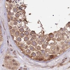 Immunohistochemical staining of human testis using Anti-CEP70 antibody HPA036942.