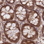Immunohistochemical staining of human colon using Anti-CEP70 antibody HPA036942.