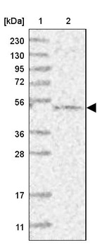 Anti-CEP70 Antibody
