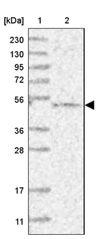 Lane 1: Marker [kDa] 230, 130, 95, 72, 56, 36, 28, 17, 11_br/_Lane 2: Human cell line RT-4