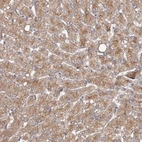 Immunohistochemical staining of human liver shows strong cytoplasmic positivity in hepatocytes.