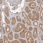 Immunohistochemical staining of human kidney shows strong cytoplasmic positivity in cells in tubules.