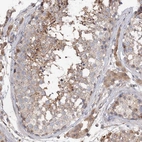 Immunohistochemical staining of the human testis shows strong cytoplasmic positivity in cells in seminiferous ducts and Leydig cells.