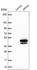 Western blot analysis in control (vector only transfected HEK293T lysate) and GRINA over-expression lysate (Co-expressed with a C-terminal myc-DDK tag (~3.1 kDa) in mammalian HEK293T cells, LY422906).
