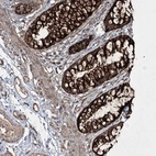 Immunohistochemical staining of human colon shows strong cytoplasmic granular positivity in glandular cells.