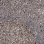 Immunohistochemical staining of human lymph node shows moderate cytoplasmic granular positivity in germinal center cells.