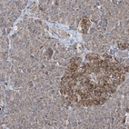 Immunohistochemical staining of human pancreas shows moderate cytoplasmic granular positivity in islets of Langerhans.