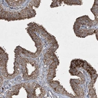 Immunohistochemical staining of human fallopian tube shows moderate cytoplasmic granular positivity in glandular cells.