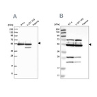 Western blot analysis using Anti-GRSF1 antibody HPA036985 (A) shows similar pattern to independent antibody HPA036984 (B).