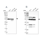 Western blot analysis using Anti-GRSF1 antibody HPA036985 (A) shows similar pattern to independent antibody HPA036984 (B).