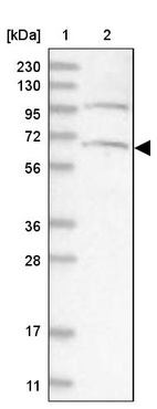 Lane 1: Marker [kDa] 230, 130, 95, 72, 56, 36, 28, 17, 11_br/_Lane 2: Human cell line RT-4