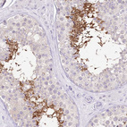 Anti-UBA6 Antibody