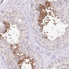 Anti-UBA6 Antibody