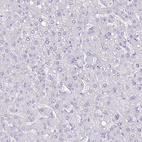 Immunohistochemical staining of human liver shows no positivity in hepatocytes as expected.