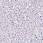 Immunohistochemical staining of human liver shows no positivity in hepatocytes as expected.