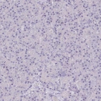 Immunohistochemical staining of human pancreas shows no positivity in exocrine glandular cells as expected.