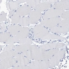 Immunohistochemical staining of human skeletal muscle shows no positivity in myocytes as expected.