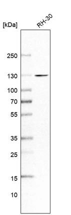 Western blot analysis in human cell line RH-30.
