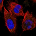 Immunofluorescent staining of human cell line U-251 MG shows no positivity.