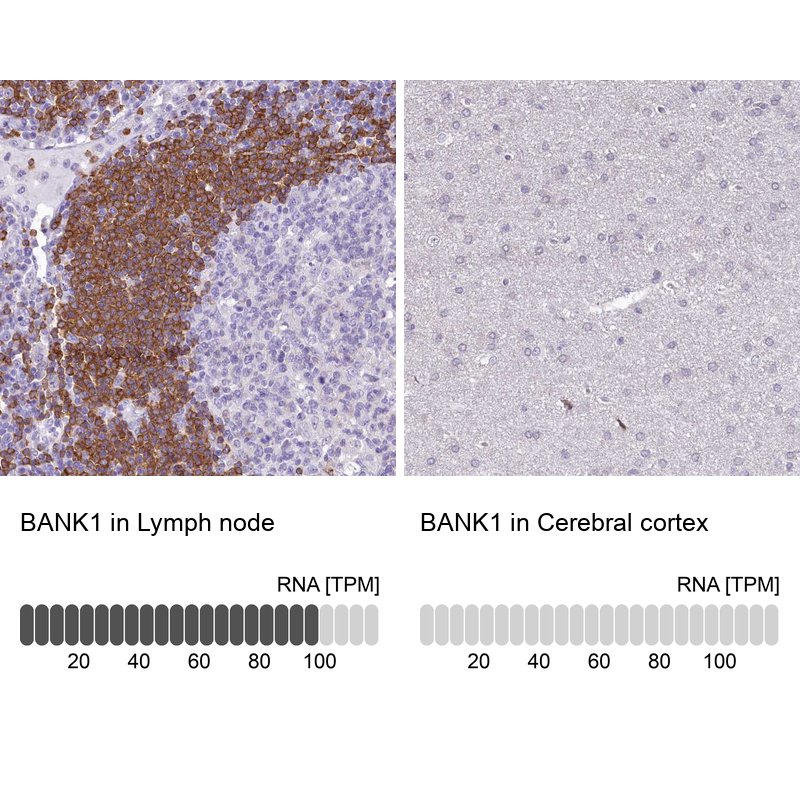 Anti-BANK1 Antibody
