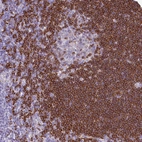 Immunohistochemical staining of human tonsil shows moderate to strong cytoplasmic positivity in germinal center cells.