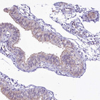 Immunohistochemical staining of human fallopian tube shows weak to moderate cytoplasmic positivity in glandular cells.