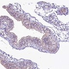 Immunohistochemical staining of human fallopian tube shows weak to moderate cytoplasmic positivity in glandular cells.