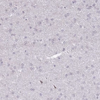 Immunohistochemical staining of human cerebral cortex shows no positivity in neurons as expected.