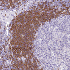 Immunohistochemical staining of human lymph node shows moderate to strong cytoplasmic positivity in germinal center cells.