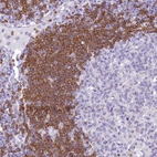 Immunohistochemical staining of human lymph node shows moderate to strong cytoplasmic positivity in germinal center cells.