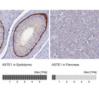 Anti-ASTE1 Antibody