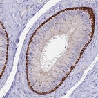 Immunohistochemical staining of human epididymis shows high expression.