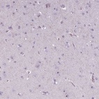 Anti-NOLC1 Antibody