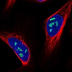 Immunofluorescent staining of human cell line U-2 OS shows localization to nucleoli.