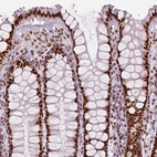 Immunohistochemical staining of human rectum shows strong nuclear positivity in glandular cells.