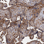 Immunohistochemical staining of human placenta shows moderate cytoplasmic positivity in trophoblastic cells.