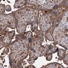 Immunohistochemical staining of human placenta shows moderate cytoplasmic positivity in trophoblastic cells.
