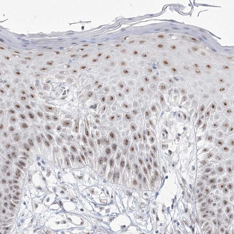 Anti-DDX50 Antibody