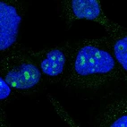 Immunofluorescent staining of human cell line A-431 shows positivity in nucleoli.