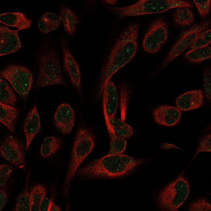 Anti-GEMIN5 Antibody