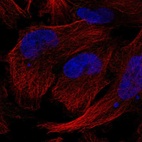 Anti-GEMIN5 Antibody