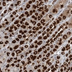 Anti-GIN1 Antibody
